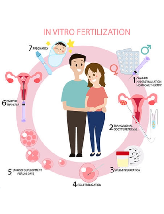 IVF
